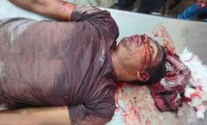 क्रेशर मशीन में एक मजदूर की मौत,जांच में जुटी पुलिस 1 IMG 20231123 WA0263 780x470 1
